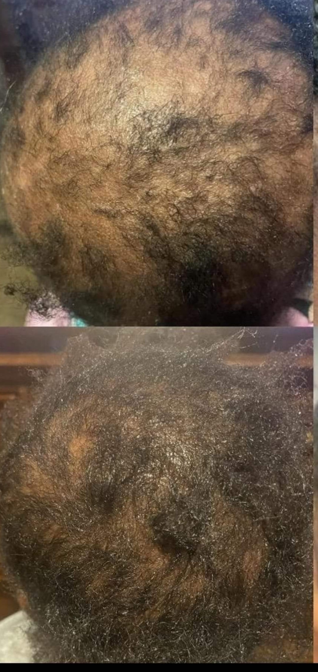 Extreme Scalp Stimulator Oil (Extra Strength Hair Serum)