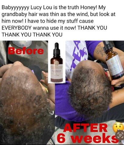 Hair Serum